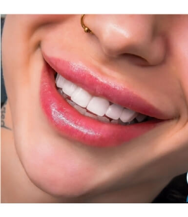 We Create Beautiful Smiles 4